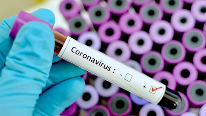 Коронавирус, эпидемия, Китай, Ухань, тесты на коронавирус